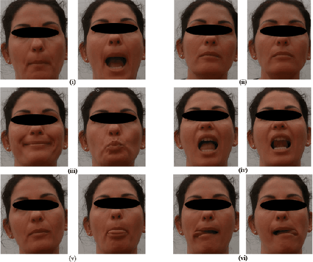 Figure 1 for A Deep Learning approach for Depressive Symptoms assessment in Parkinson's disease patients using facial videos