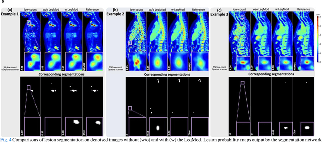 Figure 4 for LpQcM: Adaptable Lesion-Quantification-Consistent Modulation for Deep Learning Low-Count PET Image Denoising