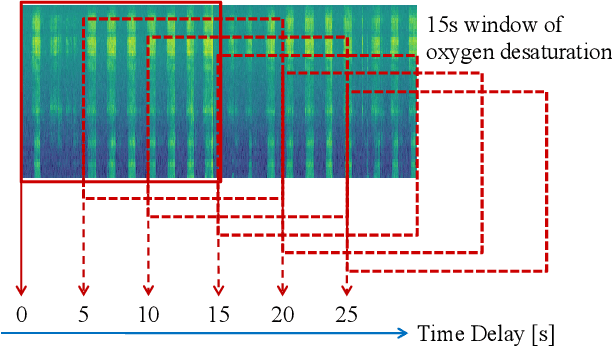 Figure 3 for Transfer Learning for Paediatric Sleep Apnoea Detection Using Physiology-Guided Acoustic Models