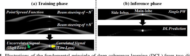Figure 1 for Deep Coherence Learning: An Unsupervised Deep Beamformer for High Quality Single Plane Wave Imaging in Medical Ultrasound