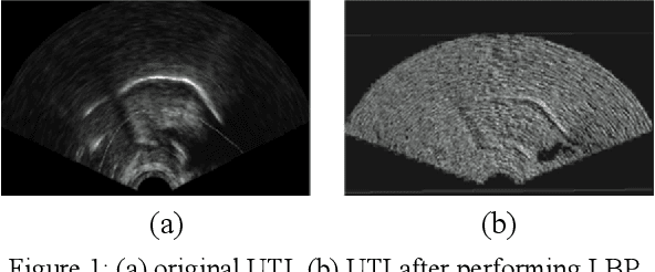 Figure 1 for Automated Classification of Phonetic Segments in Child Speech Using Raw Ultrasound Imaging