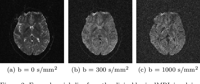 Figure 2 for MBD: Multi b-value Denoising of Diffusion Magnetic Resonance Images