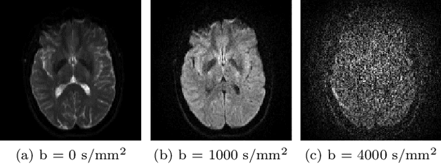 Figure 3 for MBD: Multi b-value Denoising of Diffusion Magnetic Resonance Images