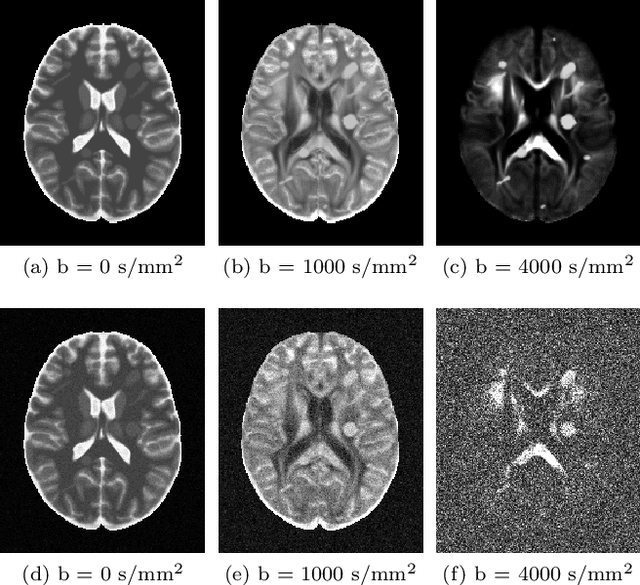 Figure 4 for MBD: Multi b-value Denoising of Diffusion Magnetic Resonance Images