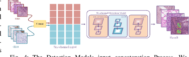 Figure 4 for Histology Virtual Staining with Mask-Guided Adversarial Transfer Learning for Tertiary Lymphoid Structure Detection