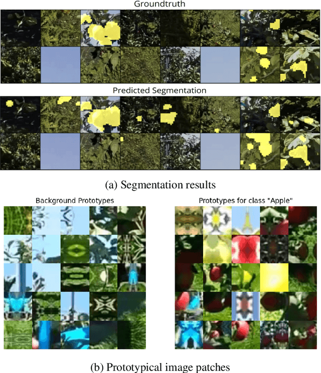 Figure 2 for A differentiable Gaussian Prototype Layer for explainable Segmentation