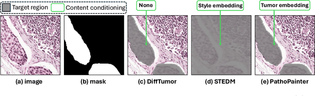 Figure 1 for PathoPainter: Augmenting Histopathology Segmentation via Tumor-aware Inpainting