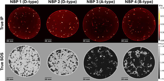 Figure 1 for Revisiting the joint estimation of initial pressure and speed-of-sound distributions in photoacoustic computed tomography with consideration of canonical object constraints