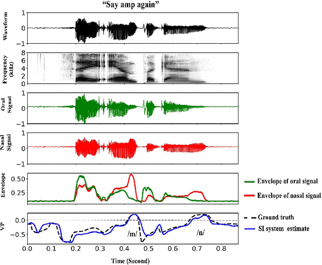 Figure 3 for Acoustic to Articulatory Speech Inversion for Children with Velopharyngeal Insufficiency