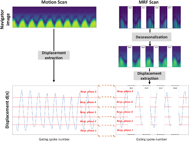 Figure 3 for Upper-body free-breathing Magnetic Resonance Fingerprinting applied to the quantification of water T1 and fat fraction