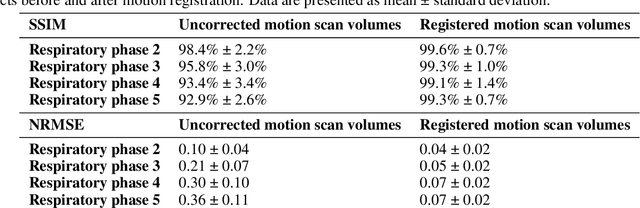 Figure 2 for Upper-body free-breathing Magnetic Resonance Fingerprinting applied to the quantification of water T1 and fat fraction