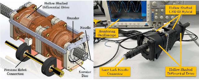 Figure 3 for A Preliminary Add-on Differential Drive System for MRI-Compatible Prostate Robotic System