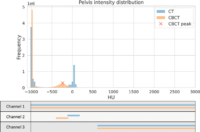 Figure 2 for A multi-channel cycleGAN for CBCT to CT synthesis