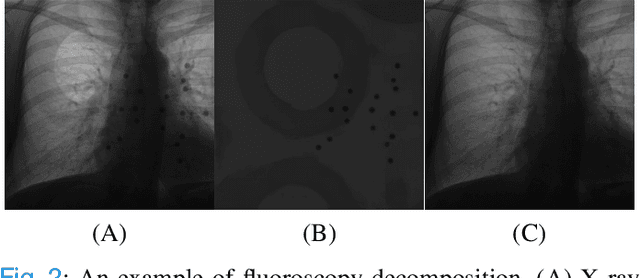 Figure 2 for Towards Seamless Integration of Magnetic Tracking into Fluoroscopy-guided Interventions