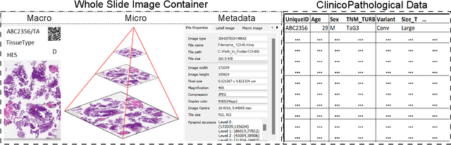 Figure 1 for Balancing Privacy and Progress in Artificial Intelligence: Anonymization in Histopathology for Biomedical Research and Education