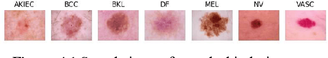 Figure 4 for Leveraging Spatial and Semantic Feature Extraction for Skin Cancer Diagnosis with Capsule Networks and Graph Neural Networks