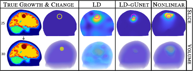 Figure 1 for Graph convolutional networks enable fast hemorrhagic stroke monitoring with electrical impedance tomography