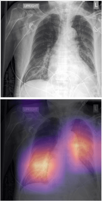Figure 1 for Explainable AI And Visual Reasoning: Insights From Radiology