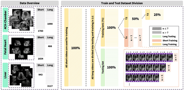 Figure 4 for Towards Better Ultrasound Video Segmentation Foundation Model: An Empirical study on SAM2 Finetuning from Data Perspective