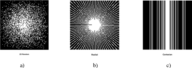 Figure 2 for Robust Depth Linear Error Decomposition with Double Total Variation and Nuclear Norm for Dynamic MRI Reconstruction