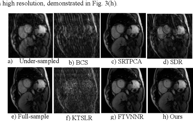 Figure 4 for Robust Depth Linear Error Decomposition with Double Total Variation and Nuclear Norm for Dynamic MRI Reconstruction