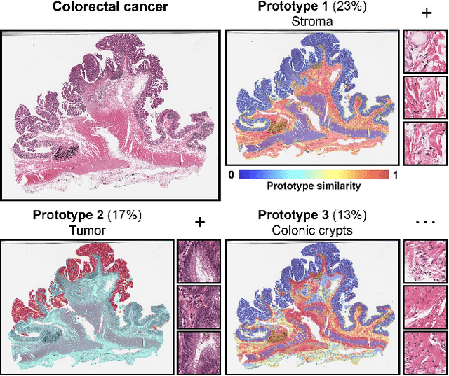 Figure 1 for Morphological Prototyping for Unsupervised Slide Representation Learning in Computational Pathology
