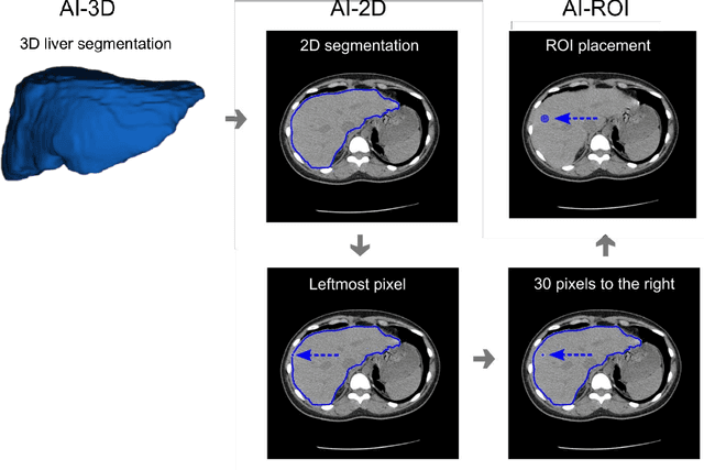 Figure 4 for Fully Automated Deep Learning-enabled Detection for Hepatic Steatosis on Computed Tomography: A Multicenter International Validation Study