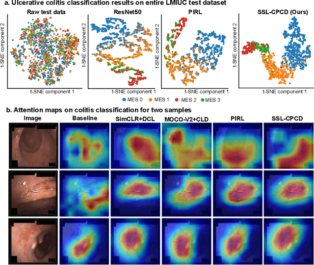 Figure 3 for SSL-CPCD: Self-supervised learning with composite pretext-class discrimination for improved generalisability in endoscopic image analysis