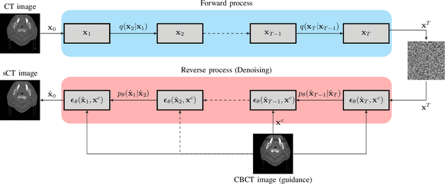 Figure 1 for EqDiff-CT: Equivariant Conditional Diffusion model for CT Image Synthesis from CBCT