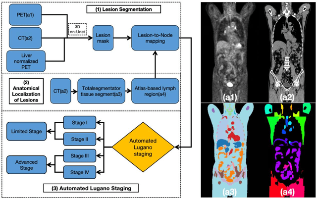 Figure 1 for AutoLugano: A Deep Learning Framework for Fully Automated Lymphoma Segmentation and Lugano Staging on FDG-PET/CT