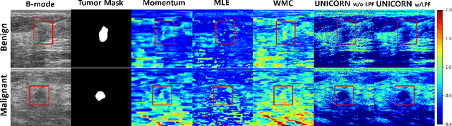 Figure 3 for UNICORN: Ultrasound Nakagami Imaging via Score Matching and Adaptation