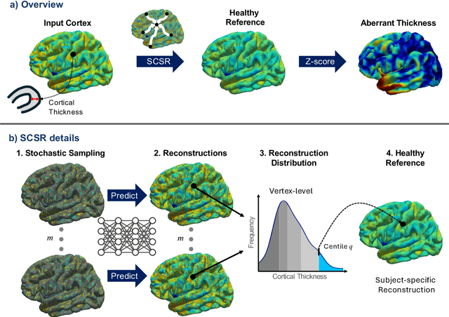 Figure 1 for Stochastic Cortical Self-Reconstruction