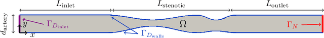 Figure 3 for A Flow-rate-conserving CNN-based Domain Decomposition Method for Blood Flow Simulations