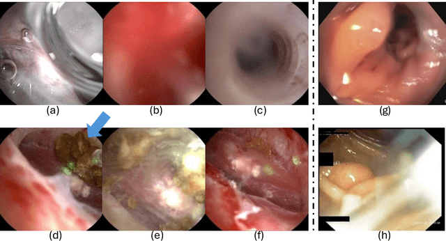 Figure 1 for Endo-SemiS: Towards Robust Semi-Supervised Image Segmentation for Endoscopic Video