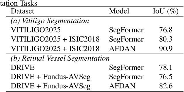 Figure 2 for Adaptive Frequency Domain Alignment Network for Medical image segmentation