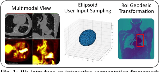 Figure 1 for Multimodal Interactive Lung Lesion Segmentation: A Framework for Annotating PET/CT Images based on Physiological and Anatomical Cues