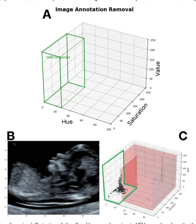 Figure 3 for Self-Supervised Ultrasound Representation Learning for Renal Anomaly Prediction in Prenatal Imaging