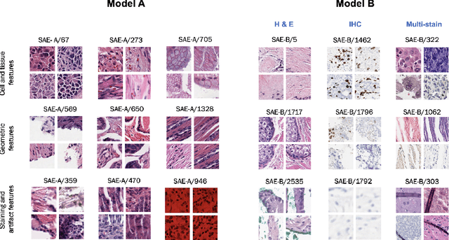 Figure 1 for Interpretability analysis on a pathology foundation model reveals biologically relevant embeddings across modalities