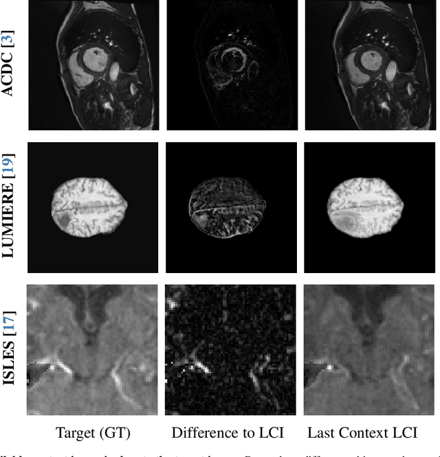 Figure 1 for Temporal Flow Matching for Learning Spatio-Temporal Trajectories in 4D Longitudinal Medical Imaging