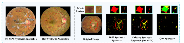 Figure 1 for ReSynthDetect: A Fundus Anomaly Detection Network with Reconstruction and Synthetic Features