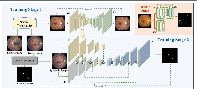 Figure 3 for ReSynthDetect: A Fundus Anomaly Detection Network with Reconstruction and Synthetic Features