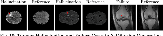 Figure 3 for X-Diffusion: Generating Detailed 3D MRI Volumes From a Single Image Using Cross-Sectional Diffusion Models