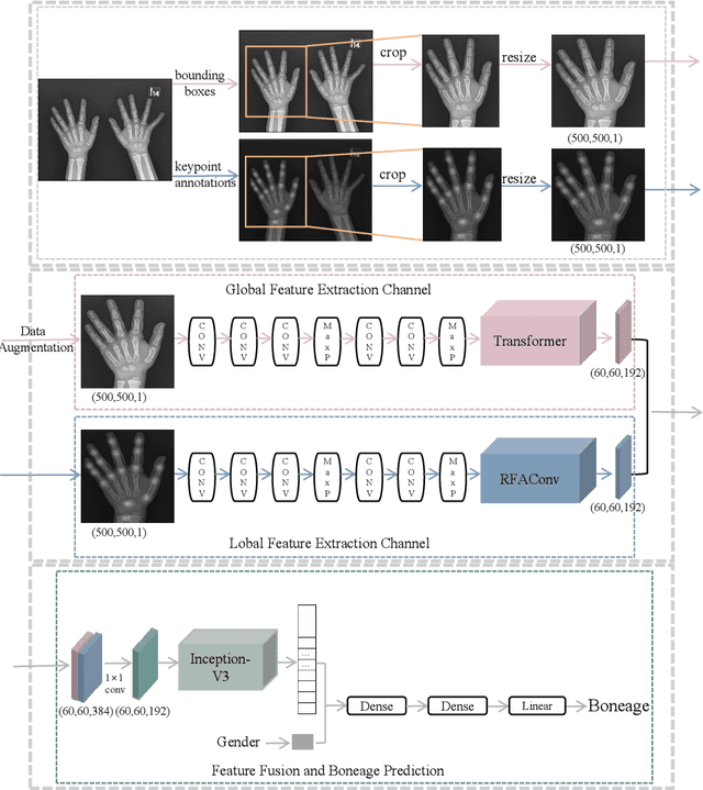 Figure 1 for A two-stream network with global-local feature fusion for bone age assessment