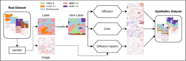 Figure 3 for Improved HER2 Tumor Segmentation with Subtype Balancing using Deep Generative Networks