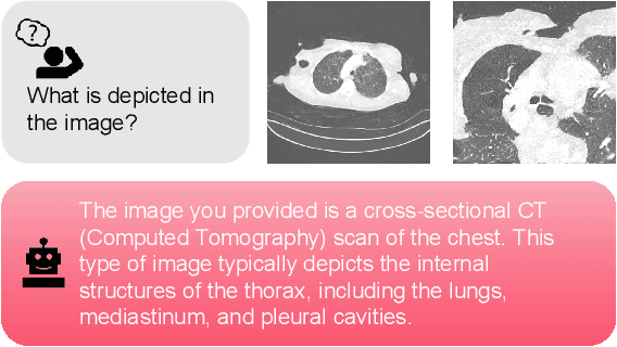 Figure 4 for Beyond the Hype: A dispassionate look at vision-language models in medical scenario
