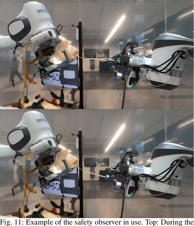 Figure 3 for Complete Autonomous Robotic Nasopharyngeal Swab System with Evaluation on a Stochastically Moving Phantom Head