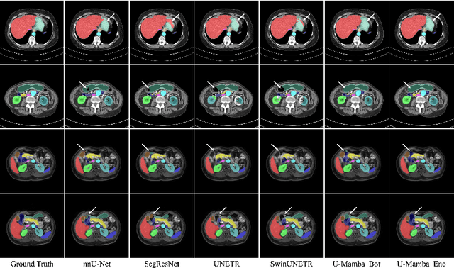 Figure 4 for U-Mamba: Enhancing Long-range Dependency for Biomedical Image Segmentation