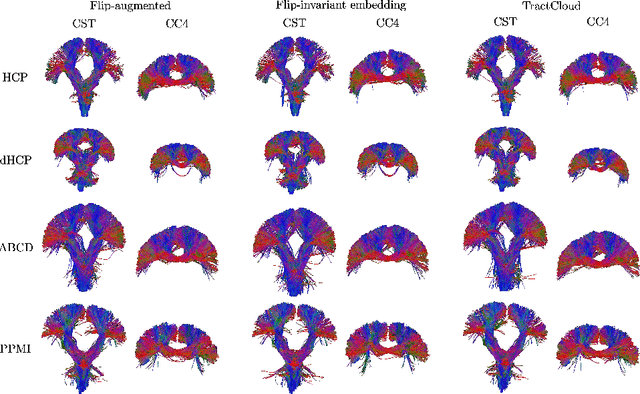 Figure 4 for Global Context Is All You Need for Parallel Efficient Tractography Parcellation