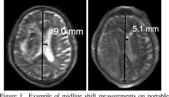 Figure 1 for Trustworthy Medical Imaging with Large Language Models: A Study of Hallucinations Across Modalities