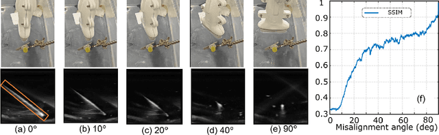 Figure 4 for Needle Segmentation Using GAN: Restoring Thin Instrument Visibility in Robotic Ultrasound